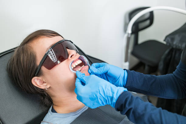 Best Emergency Wisdom Teeth Removal in USA